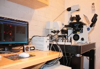 Microscopía confocal y óptica